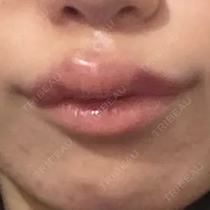 フィラークリニック フィラークリニック 新宿院口コミ