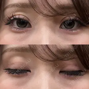 アリエル美容クリニック アリエル美容クリニック 大宮院口コミ
