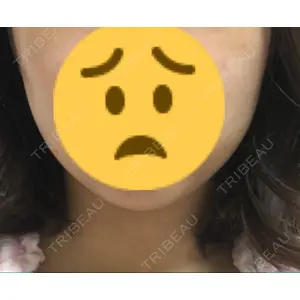 赤坂プレミアクリニック口コミ