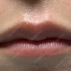 口コミ