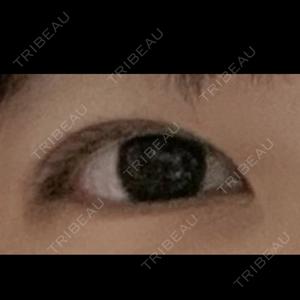 LOUIS CLINIC 二子玉川院【ルイクリニック】口コミ