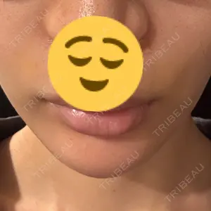 ハナビューティークリニック口コミ