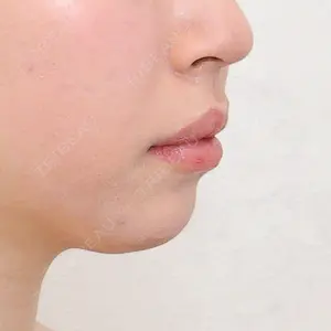 アリエル美容クリニック アリエル美容クリニック 横浜院口コミ