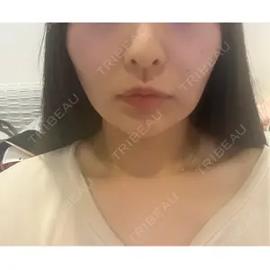 ノア美容クリニック ノア美容クリニック 飯田橋院口コミ