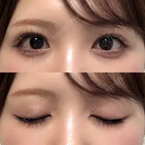 口コミ