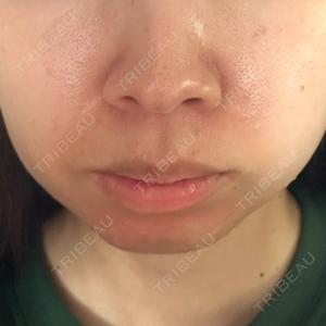 DMTC CLINIC DMTC美容皮膚科 大宮院口コミ