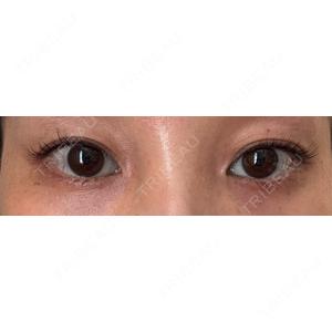 湘南美容クリニック 湘南美容クリニック 名古屋栄院口コミ