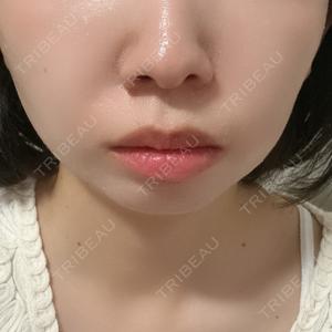 DMTC CLINIC DMTC美容皮膚科 大宮院口コミ