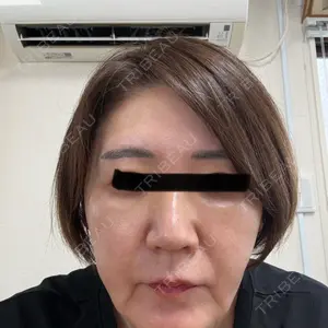 口コミ