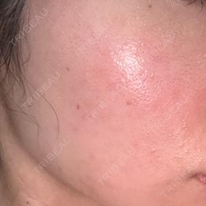 Fellez Clinic【フェルズクリニック】口コミ