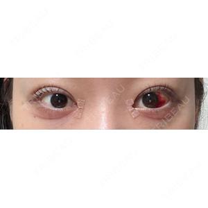 銀座みゆき通り美容外科 銀座みゆき通り美容外科 大阪梅田院口コミ