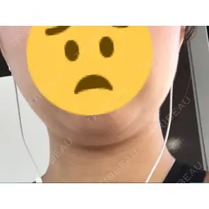 赤坂プレミアクリニック口コミ