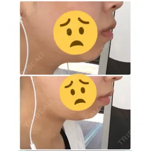 赤坂プレミアクリニック口コミ