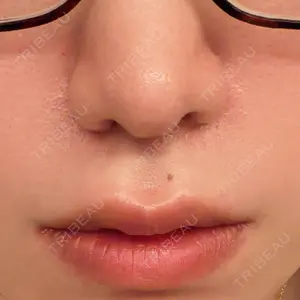 口コミ
