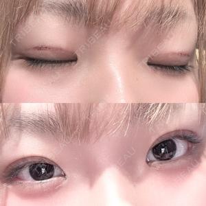 パルム美容クリニック口コミ