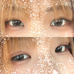 パルム美容クリニック口コミ