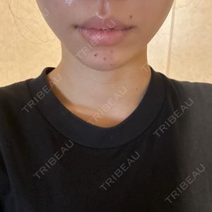 BITO BEAUTY CLINIC BITO BEAUTY CLINIC口コミ