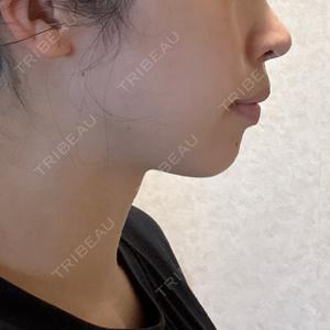 BITO BEAUTY CLINIC BITO BEAUTY CLINIC口コミ