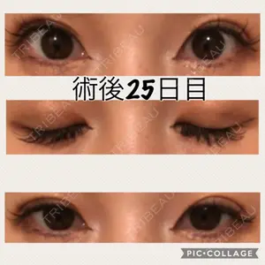 口コミ