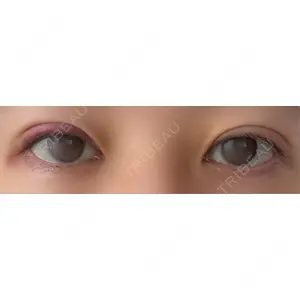 東京BELLEZZAクリニック口コミ