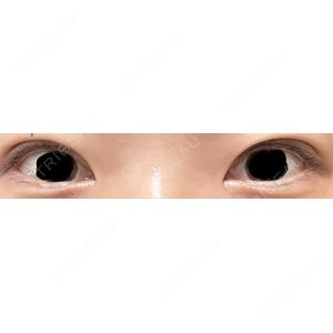LUHO（ルホ）美容外科の