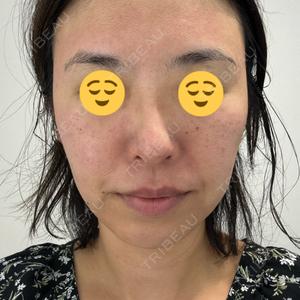 ビラビューティークリニック 博多美容外科/美容皮膚科 ビラビューティークリニック口コミ