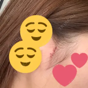 View美容整形外科口コミ