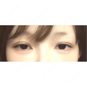 口コミ