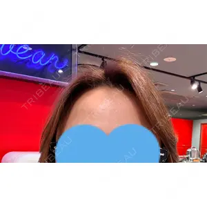 TCB東京中央美容外科 TCB東京中央美容外科 自由が丘院口コミ