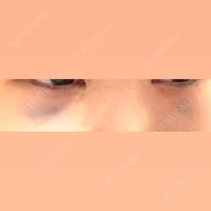 銀座みゆき通り美容外科 銀座みゆき通り美容外科 大阪梅田院口コミ