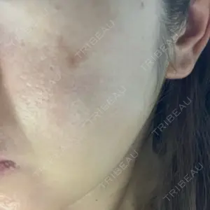 ルラ美容クリニック ルラ美容クリニック 福岡本院口コミ