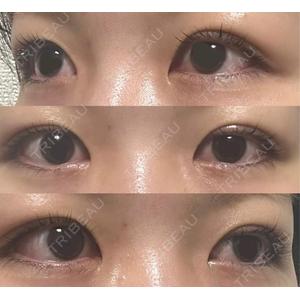 LUHO（ルホ）美容外科口コミ