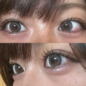 口コミ