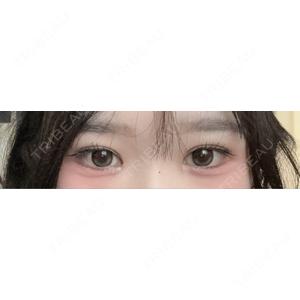 LUHO（ルホ）美容外科口コミ