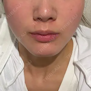 口コミ