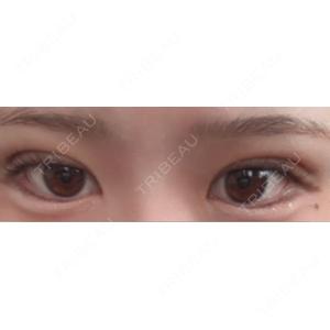 アリエル美容クリニック アリエル美容クリニック 郡山院口コミ
