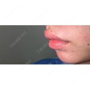 ビラビューティークリニック 博多美容外科/美容皮膚科 ビラビューティークリニック口コミ