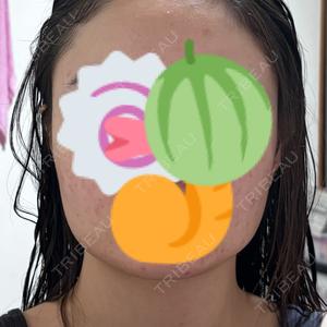 DMTC CLINIC DMTC美容皮膚科 大宮院口コミ