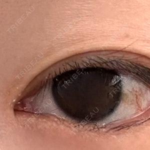 銀座みゆき通り美容外科 銀座みゆき通り美容外科 大阪梅田院口コミ