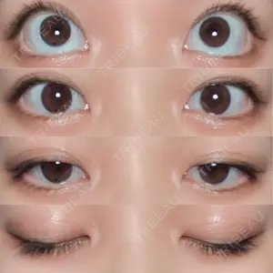 口コミ