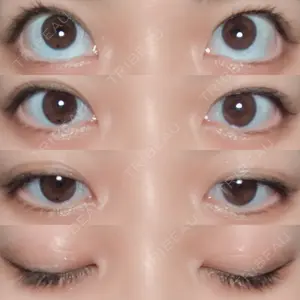 口コミ