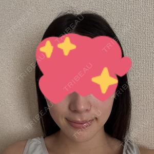 Chloe Cheongdam Clinic （クロエチョンダムクリニック）口コミ