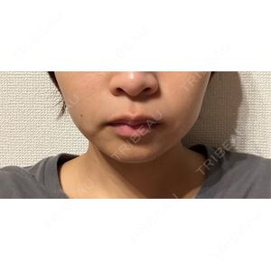 DMTC CLINIC DMTC美容皮膚科 大宮院口コミ