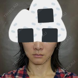 TCB東京中央美容外科 TCB東京中央美容外科 銀座有楽町院口コミ