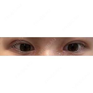 アリエル美容クリニック アリエル美容クリニック 郡山院口コミ