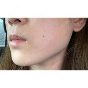 DMTC CLINIC DMTC美容皮膚科 大宮院口コミ