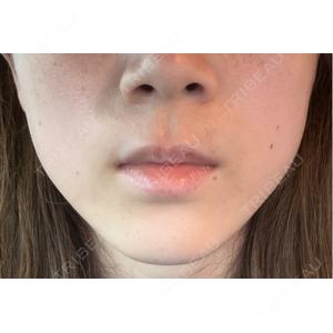 DMTC CLINIC DMTC美容皮膚科 大宮院口コミ