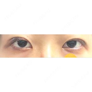 ASTRA BEAUTY CLINIC口コミ