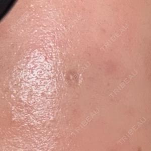 CLEAN BEAUTY CLINICの口コミ