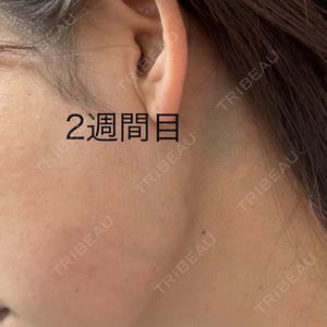 共立美容外科・歯科 共立美容外科 神戸三宮院口コミ